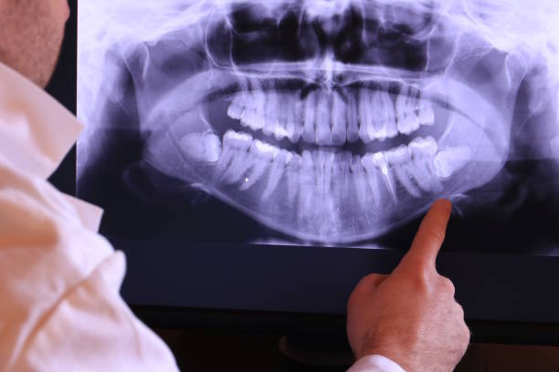 Best Emergency Dental Surgery in Tatamy, PA